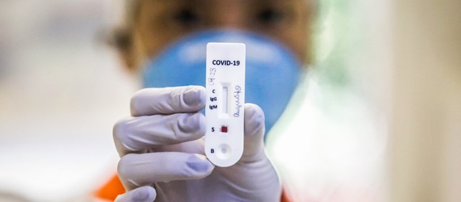 Coronavirus Rio De Janeiro Disponibiliza Agendamento Do Teste Pelo Aplicativo Dados Do Bem Tudocelular Com