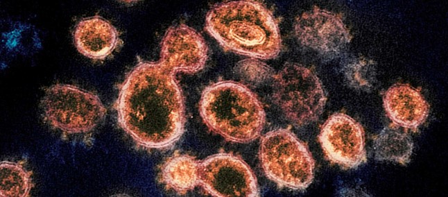 Coronavírus: CIA diz que não descarta possibilidade da doença ter vazado de  laboratório chinês - TudoCelular.com