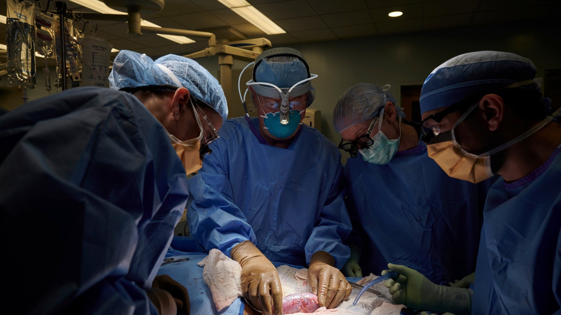 Mdicos realizam transplante de rins de porco em um humano